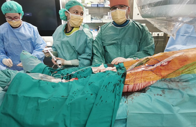 Hibridni kirurški poseg nam daja enovitne rešitve pri arterijskih zaporah.